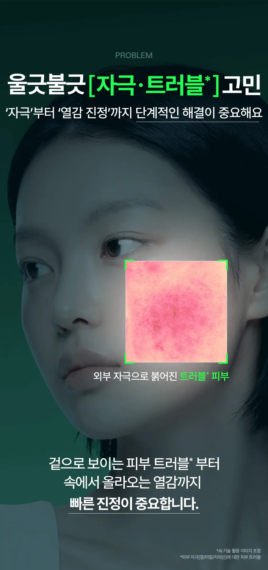 [업그레이드 수분진정세럼] 메디힐 티트리 더마 세럼 50mL 상세페이지 5